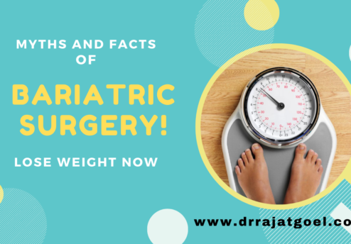 Bariatric Surgery Myths and Facts
