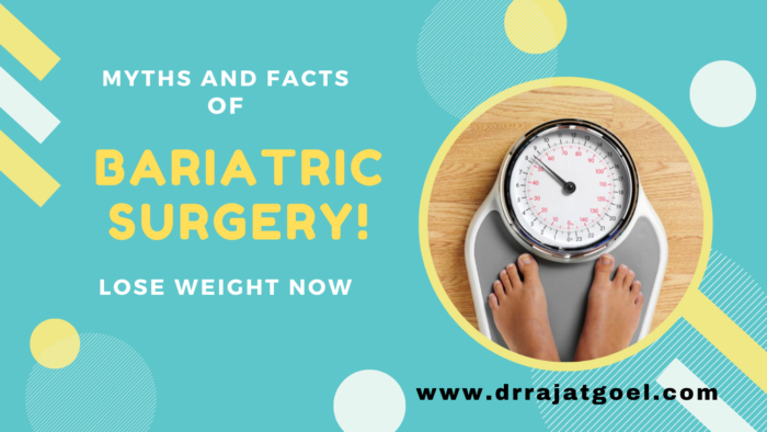Bariatric Surgery Myths and Facts